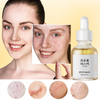 Propolis Acne Serum-Soothing, Oil-Control & Pore-Refining for Sensitive Skin