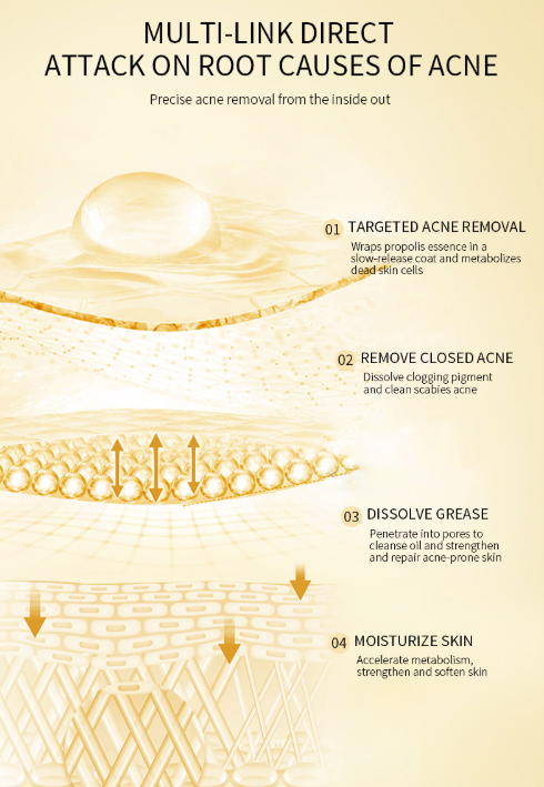 Propolis Acne Serum-Soothing, Oil-Control & Pore-Refining for Sensitive Skin