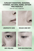 Nicotinamide Essence Improves Dullness, Brightens Skin Tone, Moisturizes And Moisturizes Essence