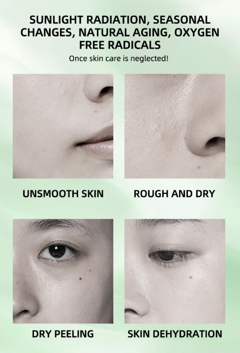 Nicotinamide Essence Improves Dullness, Brightens Skin Tone, Moisturizes And Moisturizes Essence